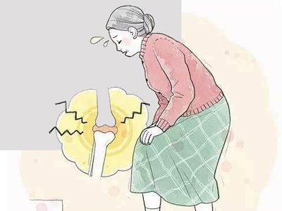 膝关节炎如何治疗